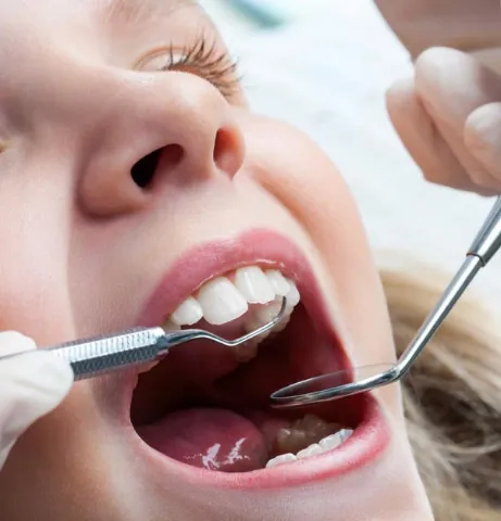 young patient getting a dental checkup at Sunnyvale Kids Pediatric Dentistry in Sunnyvale, TX